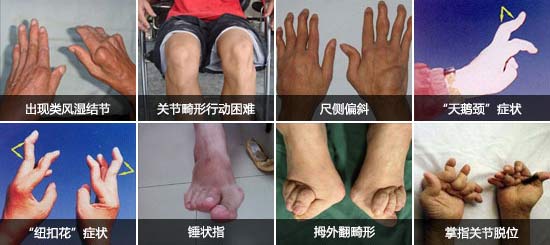 Fꖏ(qing)ֱt(y)ԺL(fng)P(gun)(ji)׿ָ_ֺȶ̎P(gun)(ji).jpg