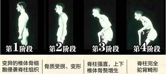 Fꖏ(qing)ֱt(y)Ժ(qing)ֱԼ׳ʹYҕ(hu)P(gun)(ji)׃ΣΣ.jpg