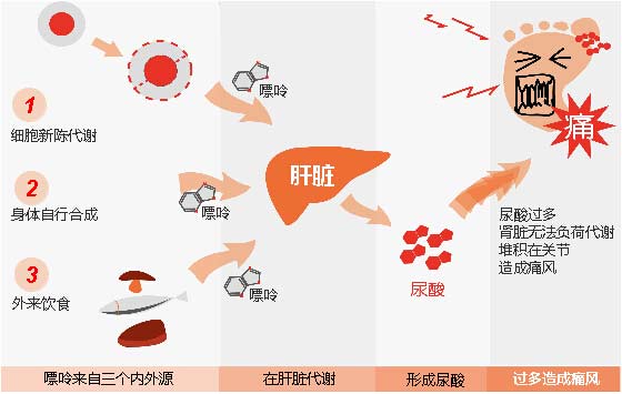 貴陽強直醫(yī)院痛風形成原理.jpg